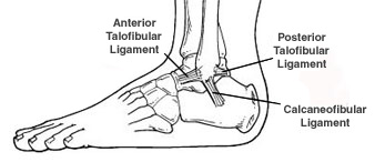 Ankle Sprain_OCfeet.com