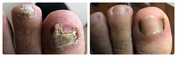 Before and After 1