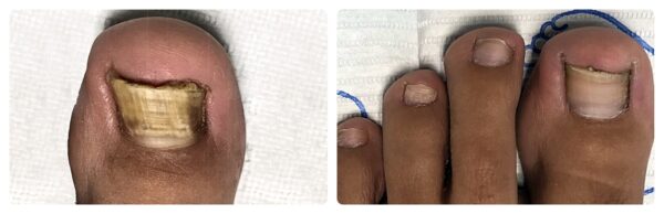 Before and After 2
