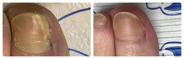 Before and After 3