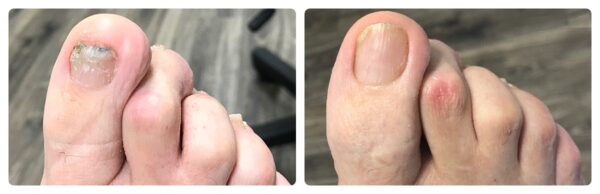 Before and After 4