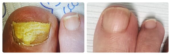 Before and After 5