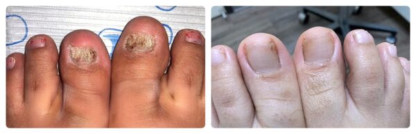 Before and After 6