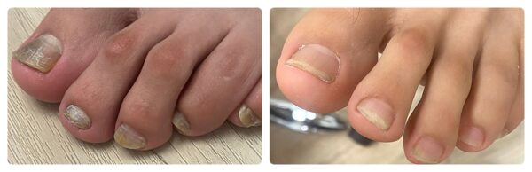 Before and After 7
