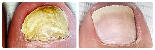 Before and After 8