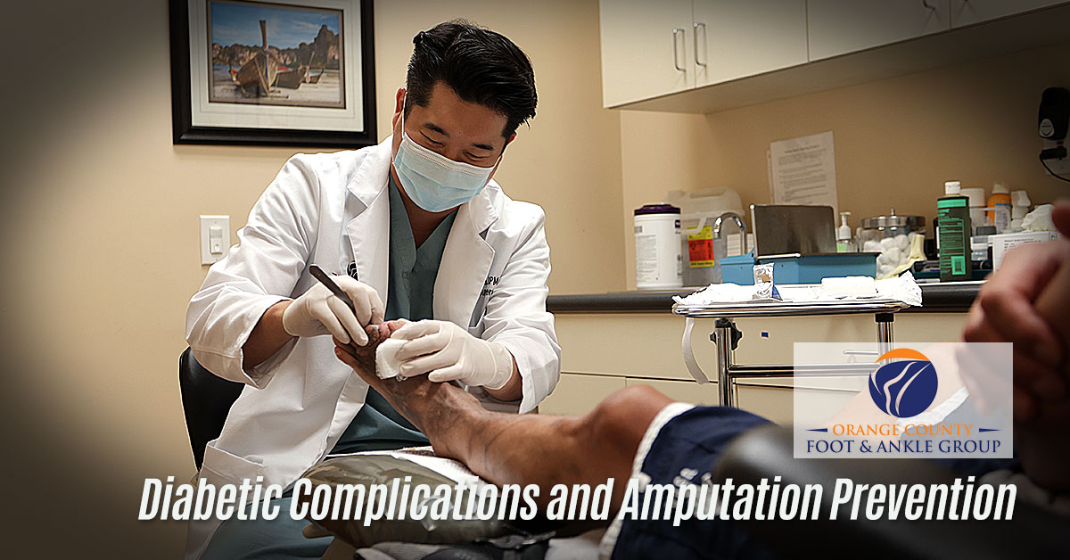 Diabetic Wound Care