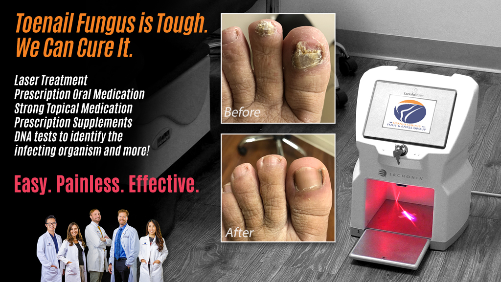 Topical medication