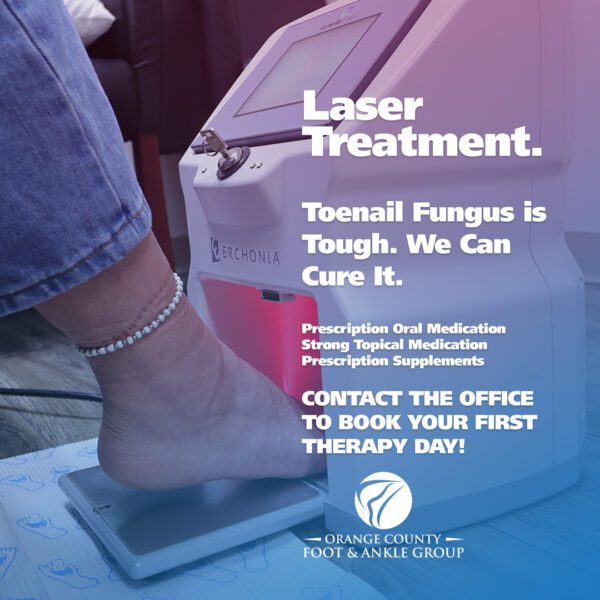 Toenail Fungus Example 1
