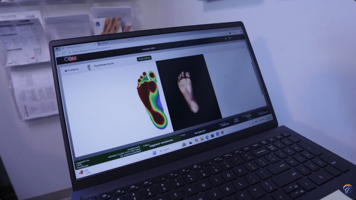 Orthotics replacement
