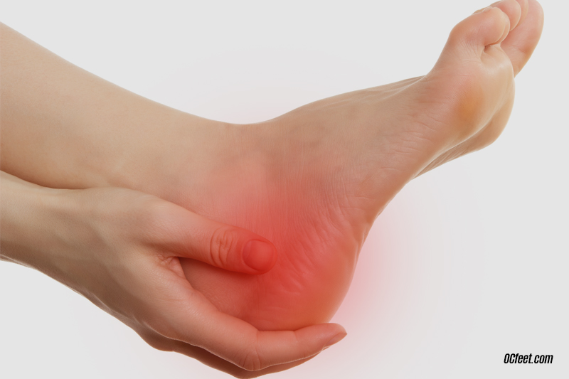 Heel Pain – Plantar Fasciitis | OC Feet